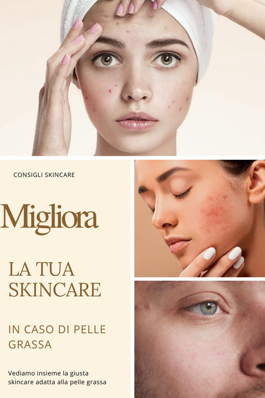 Migliora la tua skincare in caso di pelle grassa.