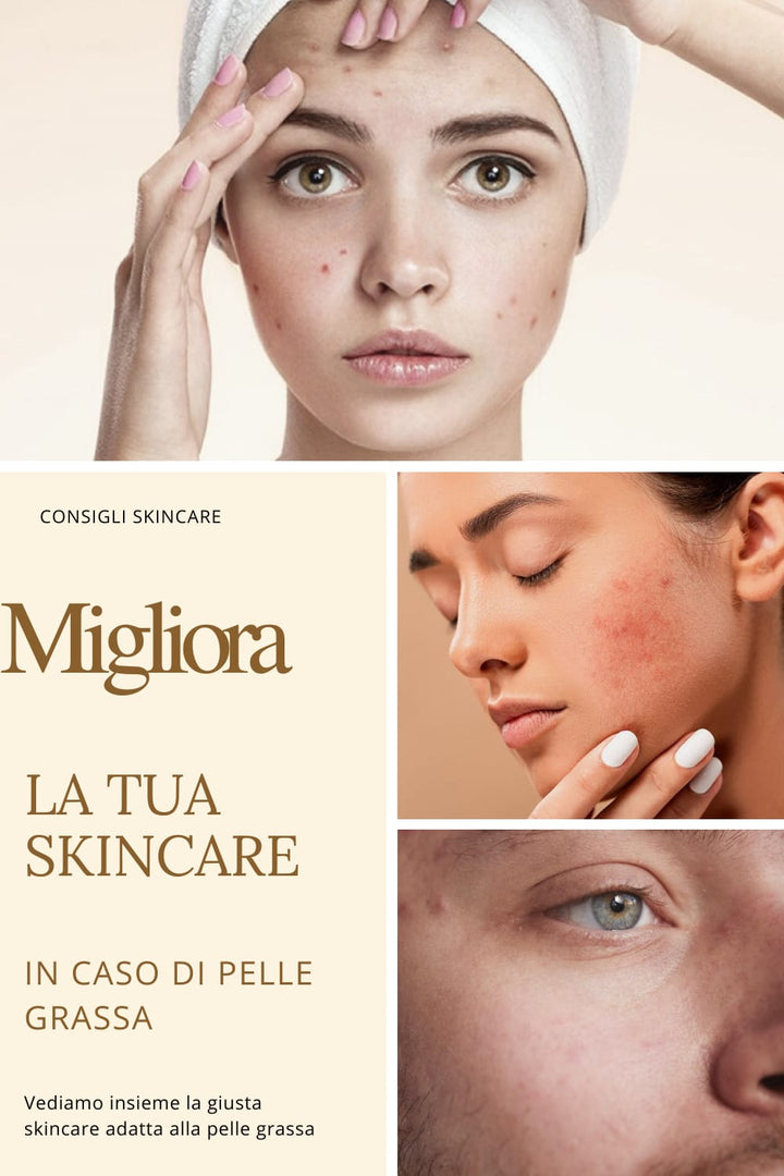 Migliora la tua skincare in caso di pelle grassa.